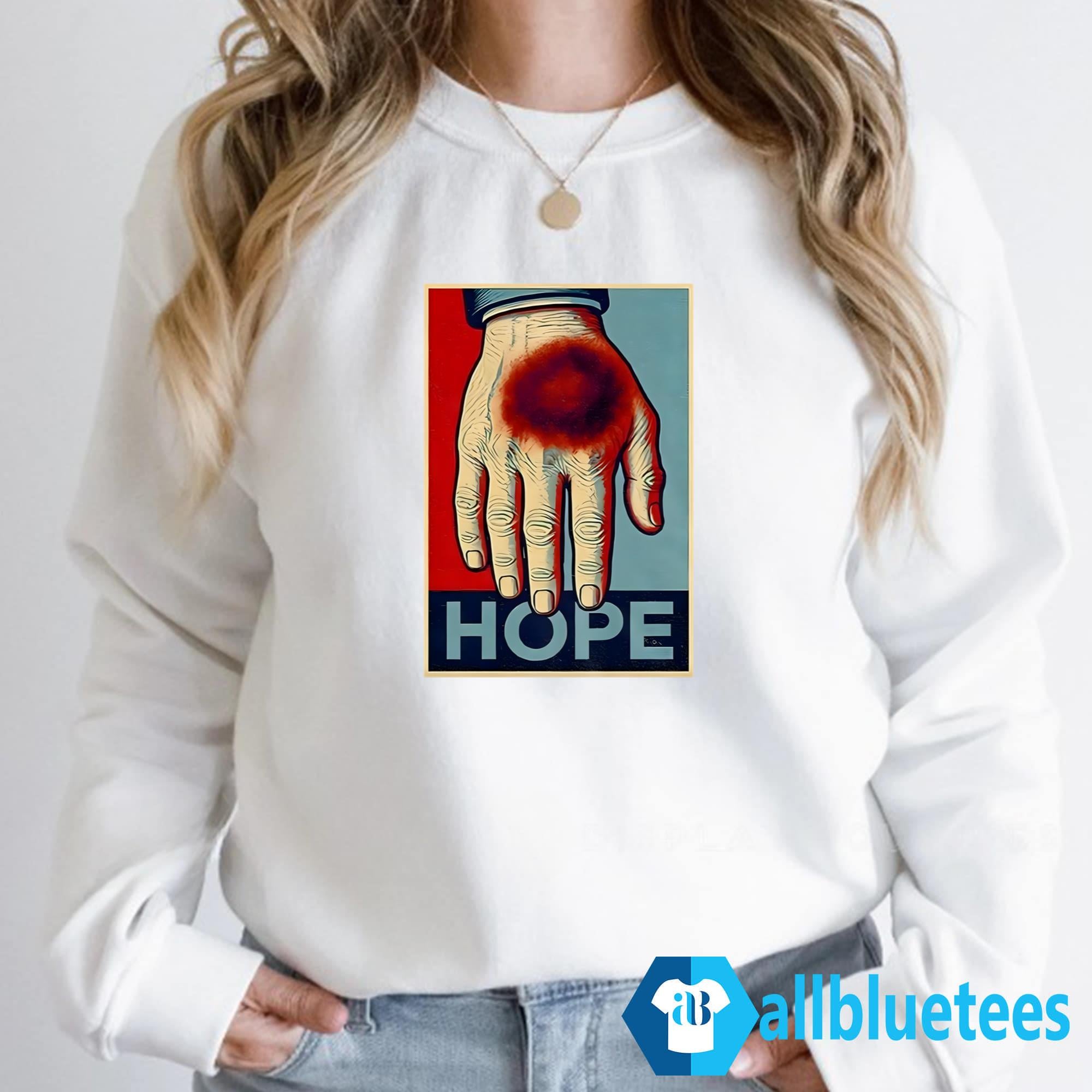 Hope The Bruise On The Hand Shirt