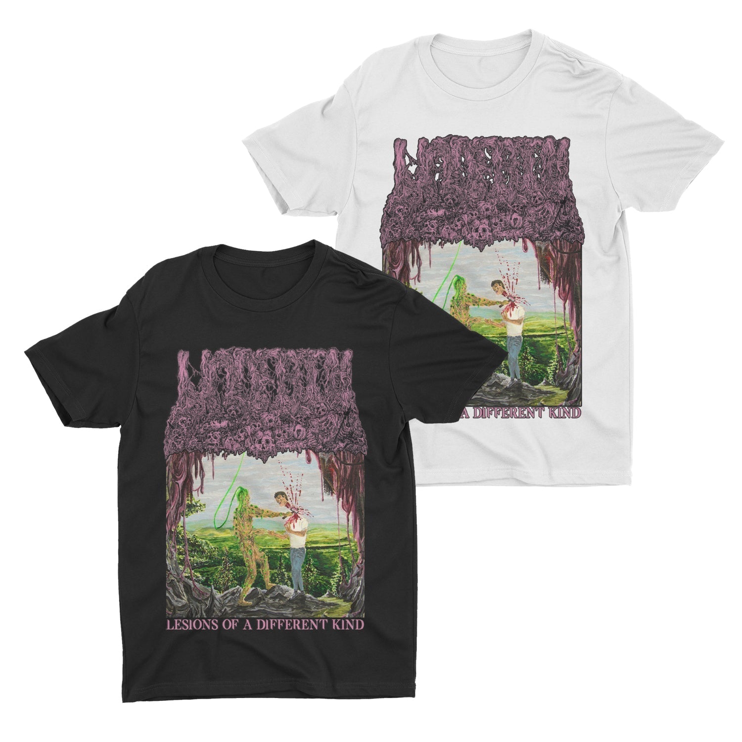 Undeath - Lesions Of A Different Kind t-shirt Hoodie, Sweatshirt | CoreVibeTees.com (Image 1)